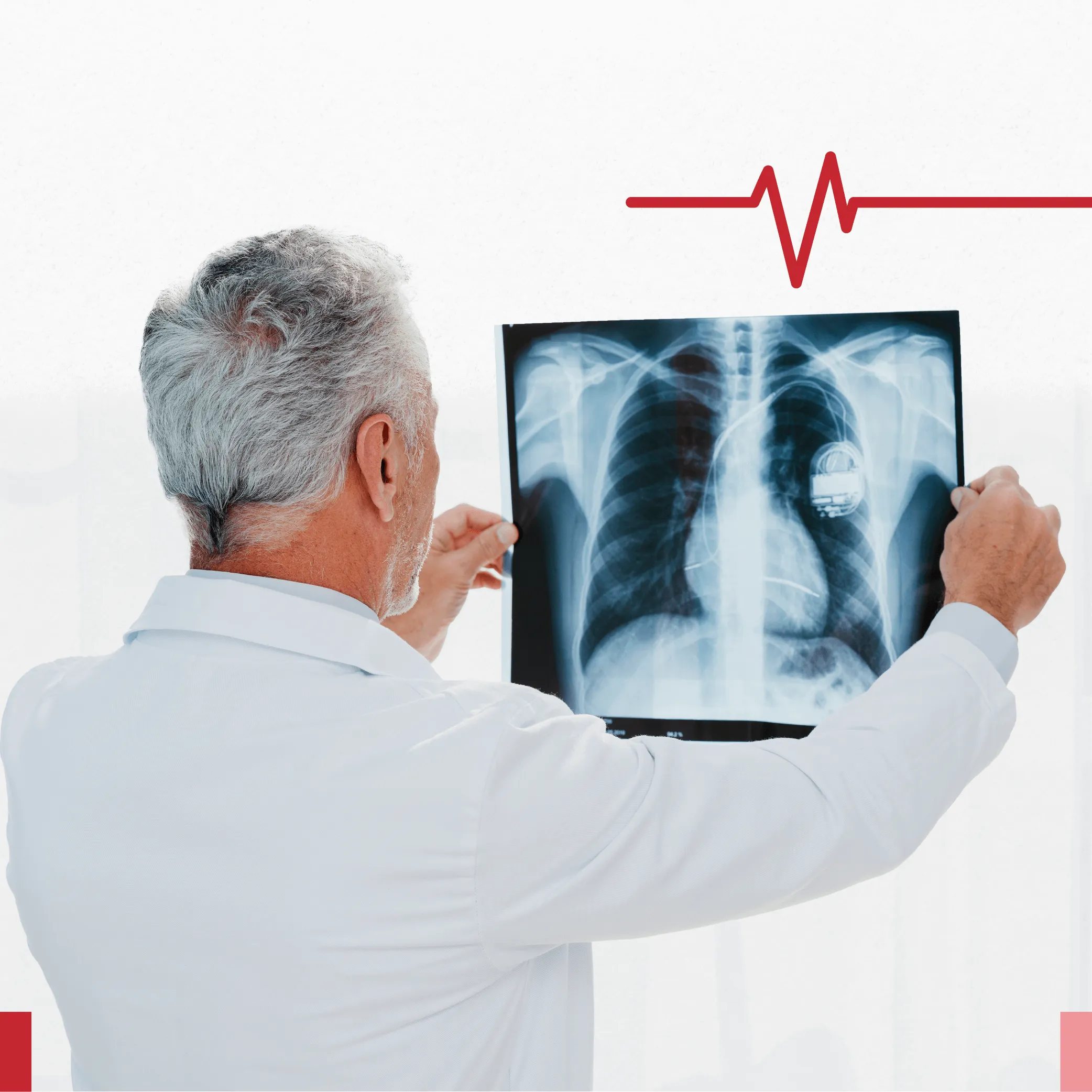 أشعة منزلية