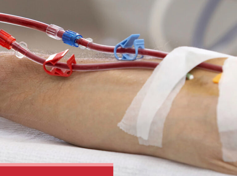 Dialysis